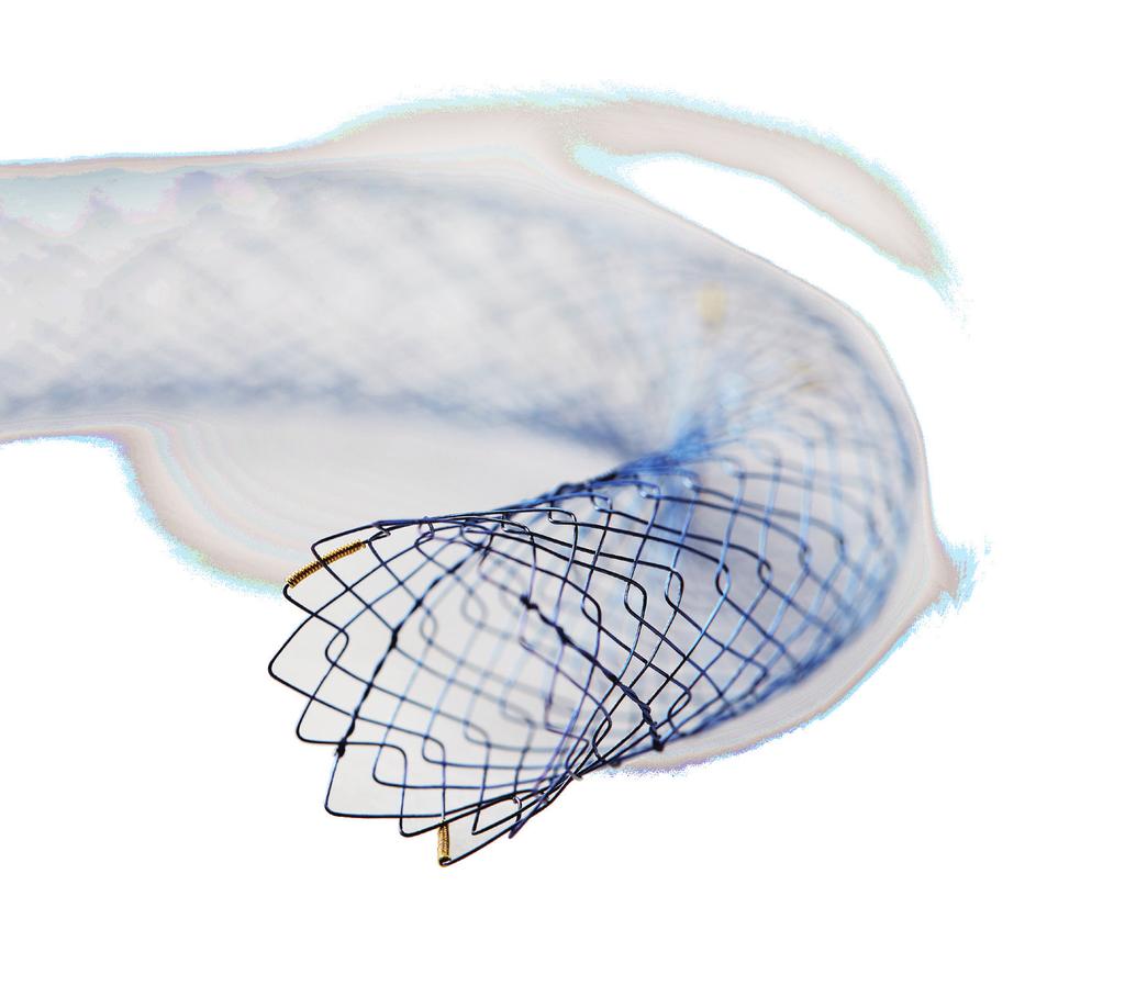 Biliary Metal Stents In a fast paced and maturing market, Diagmed Healthcare s Hanarostent has