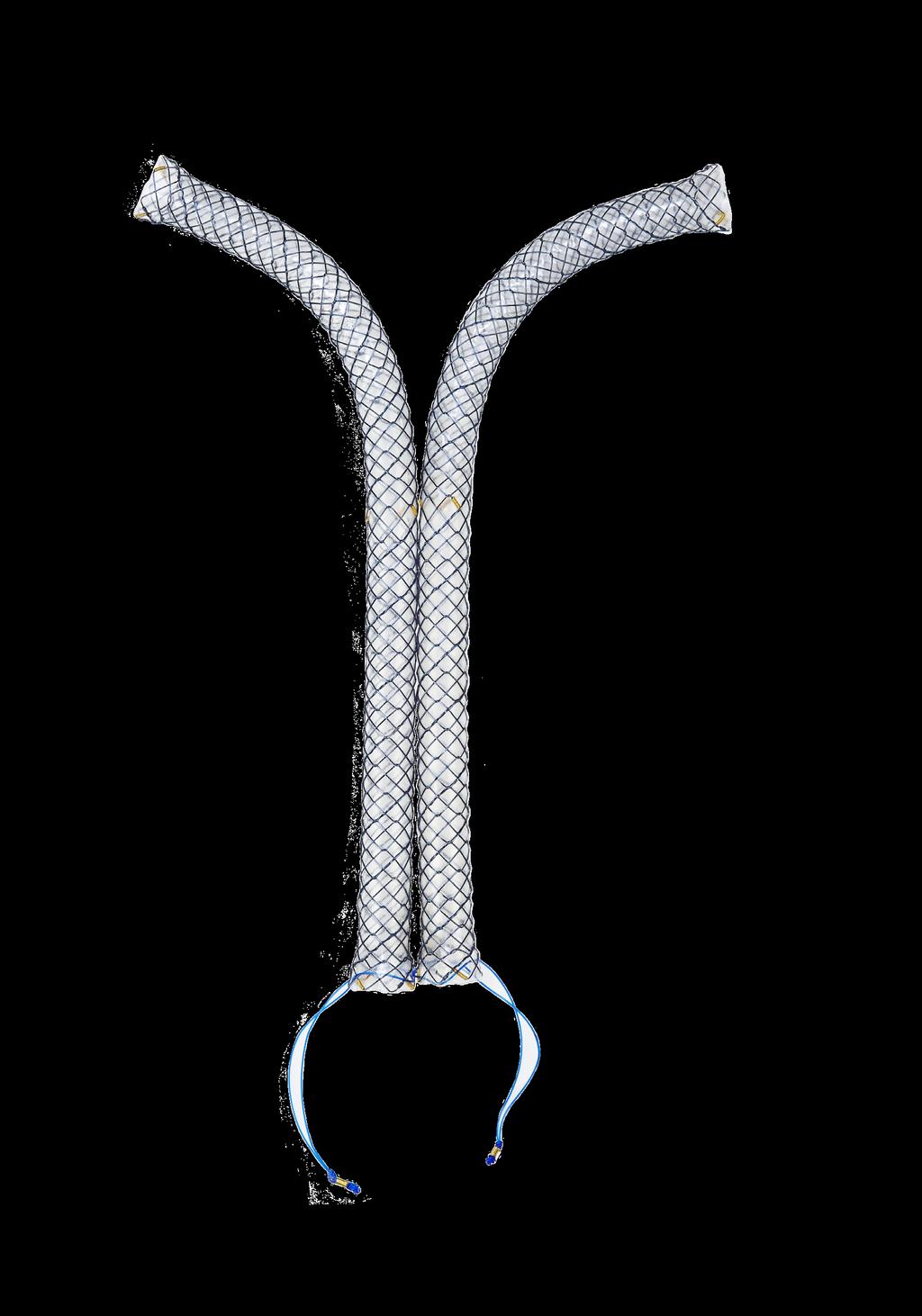 SHCL Stent 2 GOLD R ADI OOPAQUE M AR KER S To allow side-by-side placement in hilar ducts NITINOL METAL MESH To enhance stent patency SHCL Covered Biliary Stent Indication: This stent is indicated