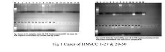 the basis for vaccination program in prevention of HNSCC in developing countries.