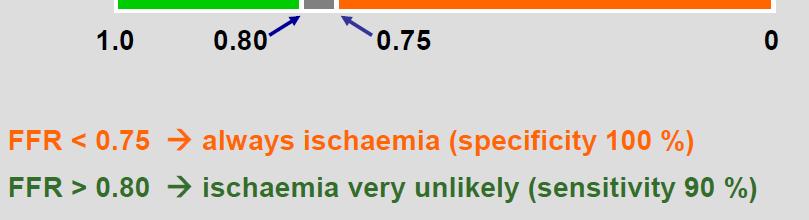 FFR: ischaemic threshold A cut-off value reflecting the presence or absence of ischaemiahasbeen prospectively defined and compared with the