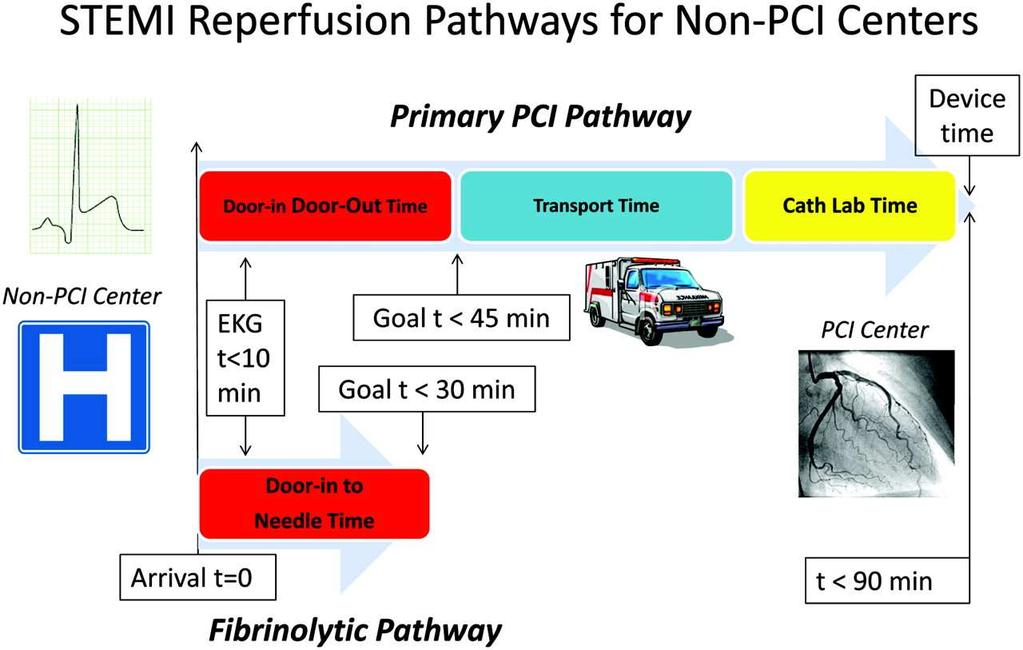 ST-segment elevation myocardial infarction reperfusion pathways for non percutaneous coronary intervention (PCI) centers.