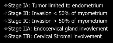 gland invovlement Stage IIB: Cervical Stromal