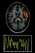 FUNCTIONAL MRI AND PET Although EEG/MEG signals are good for monitoring the electrical and magnetic field activity over the skull, spatial resolution depicted by EEG/MEG signals over the brain is