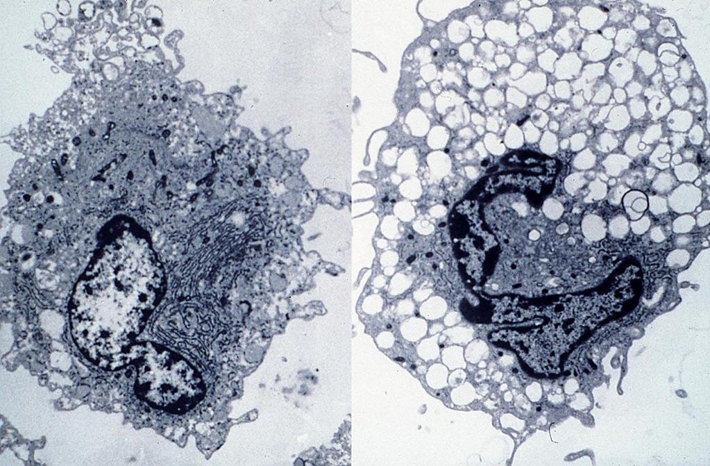 lysosomes nucleus Normal