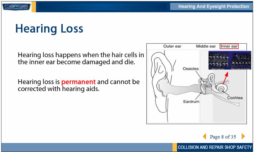 Hearing loss happens when the tiny hair cells in the inner ear become damaged and die.