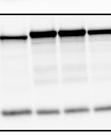 By contrast, recombinant mutant GFP-Ras