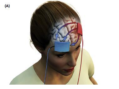 Transcranial electric stimulation - TES TES uses low level (1-2 ma) currents applied via scalp electrodes to specific brain
