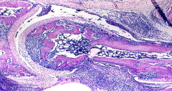 mice developed polyarthritis with synovial