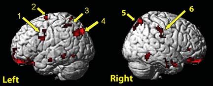 , wrist/toe) Mirror Neurons/ Merging of Action/Perception (Basketball example in video) Observers with skill