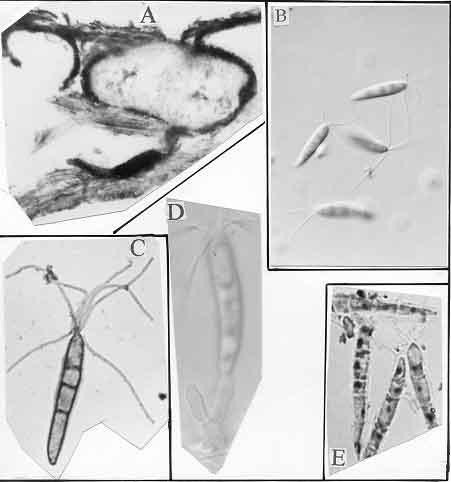 250 S.Q. ABBAS ET AL., Fig. 1. Alpakesiopsis ghaffarii (A) V.S. of conidioma, 100X; (B) conidia, 1000X; (C) conidia stained in Leifson s flagella stain, 1800X; (D) conidiogenous cells with conidia, 1800X; (E) conidia stained in Geimsa HCl stain, 1800X.