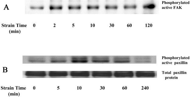 G79 Fig. 3. Effect of MEK inhibition by PD-98059 on strain-associated ERK (A) and p38 (B) activation.