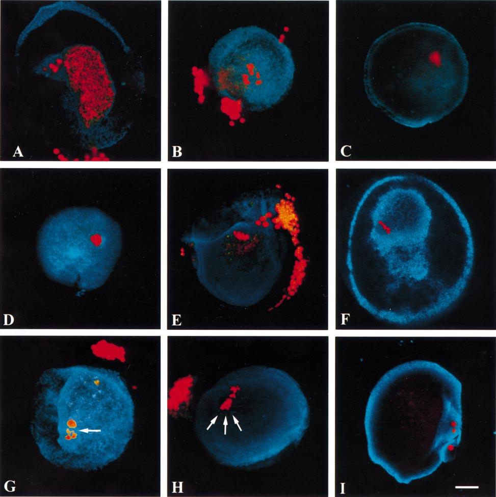 N.-H.Kim et al. Figure 2. Immunofluorescence localization of microfilaments in maturing human oocytes. Blue: microfilaments; red: DNA. Bar 25 µm.