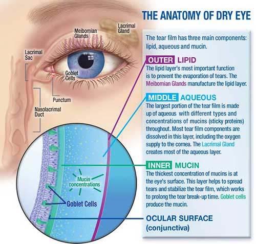Prevalence of Dry Eye Also Known As Keratoconjunctivitis Sicca (KCS) Incidence and Classification Two to Three times more Women than Men Age is # 1 Factor Pre Clinical/Marginal/ Enviromental/SAD = 1.