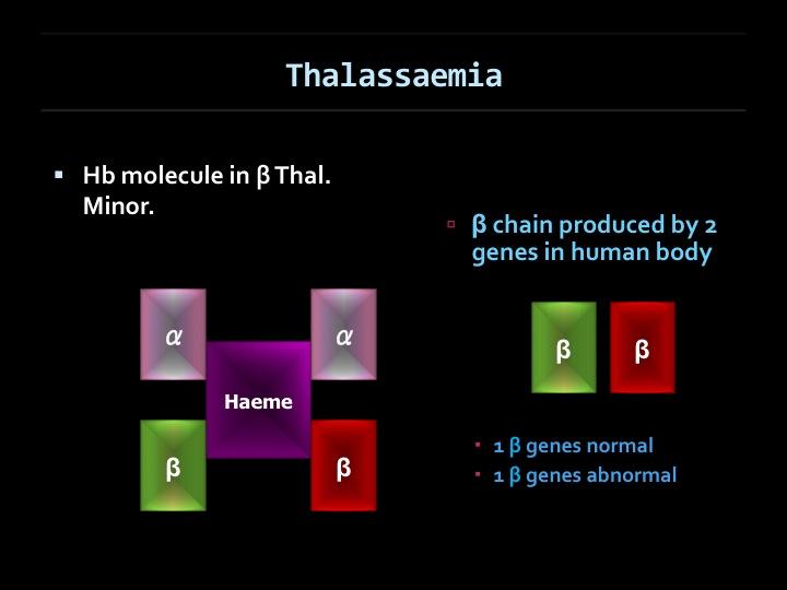Fig 2: shw the defect in β Thalassaemia Minr where there is quantitative defect in ne β chain.