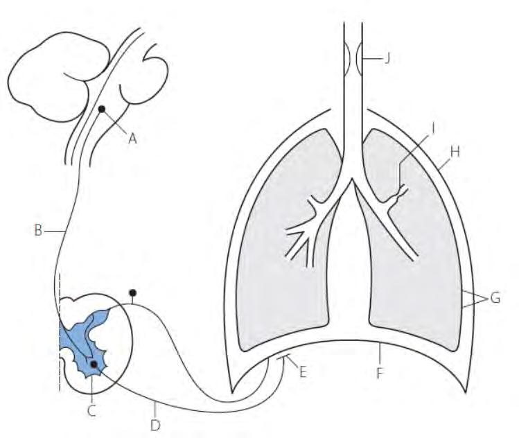 CAUSES OF VENTILATORY FAILURE Upper airway obstruction Respiratory centre Increased resistance of small airways Loss of structural integrity of chest wall
