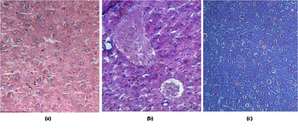 640 Histopathological observations Histopathological observations showed severe necrosis, fatty infiltration, fibrosis, and lymphocyte infiltration in the hepatocyte of CCl 4 alone treated animals