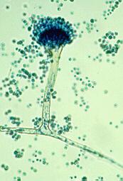 Conidial heads are short, columnar (up to 70 x 30 um in diameter) and biseriate. Conidiophores are usually short, brownish and smooth-walled. Conidia are globose (3.