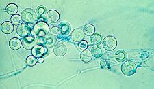 Clinical significance Aspergillus nidulans is a typical soil fungus with a world-wide distribution. It has also been reported as a causative agent of aspergillosis in humans and animals.