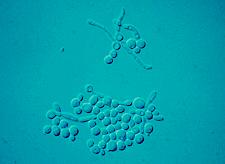 Microscopic morphology shows spherical to subspherical budding yeast-like cells or blastoconidia, 2.0-7.0 x 3.0-8.5 um in size.