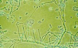 3 Acremonium sp. Acremonium sp. showing long awl-shaped phialides producing cylindrical, one-celled conidia mostly aggregated in slimy heads at the apex of each phialide.
