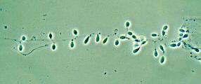 Conidia are typically pyriform to clavate with truncate bases (6 to 7 by 3.5 to 4 um) and are formed either intercalary (arthroconidia), laterally (often on pedicels) or terminally.