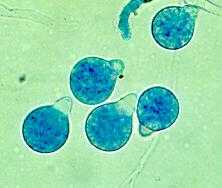 Conidia may also produce hair-like appendages called villae.