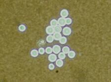 neoformans India Ink Preparation: Positive - distinct, wide gelatinous capsules surrounding the yeast cells are present. Dalmau Plate Culture on Cornmeal and Tween 80 Agar: Budding yeast cells only.