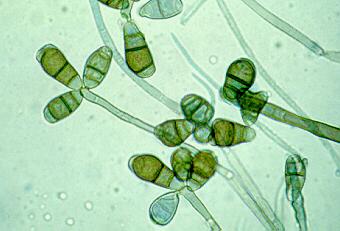 Drechslera. Conidia are cylindrical or slightly curved, with one of the central cells being larger and darker. Germination is bipolar and some species may have a prominent hilum.