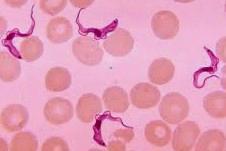 stained blood films Polymorphic Trypanosomes - Culture on