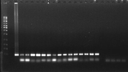 M 1 2 3 4 5 6 7 8 9 10 11 12 13 14 15 16 17 18 19 20 500 bp 300 bp 271 bp Figure 4.15 PCR amplification of the HBSAG gene (271bp) from cdna of Chlorella vulgaris.