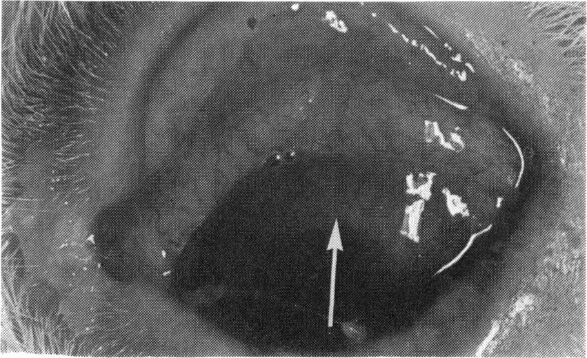 In the second experiment entropion of the lower lid was observed in 6 eyes from 15 animals examined 12 months after the fifth infection. Deformities of the upper lid were not seen.