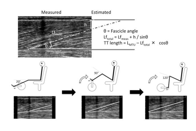 Distal MTJ Displacement Over Sets Muscle Fascicle