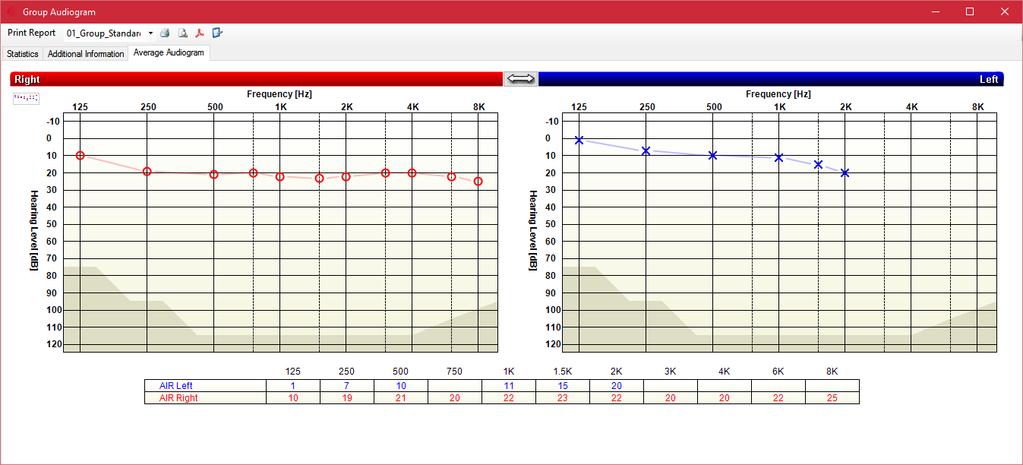 Additional Information Add information to all selected audiograms. Average Audiogram Display an average audiogram based on selected data.
