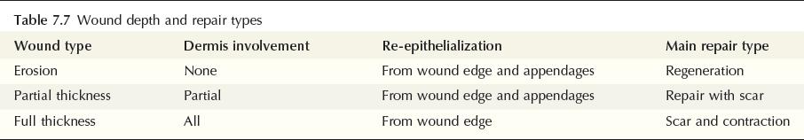 Partial-thickness versus full-thickness wounds Early fetal skin wounds regeneration can take place after dermal injury