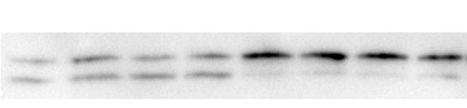 % of Atg7 genomic DNA deletion 1 0 80 60 Femur Spleen Kidney Liver LC3-I LC3-II ctin % of LC3-II/LC3-I 2.0 1.5 1.0 0.5 c LC3-I LC3-II % of LC3-II/LC3-I 1.2 0.8 0.4 Figure S1.
