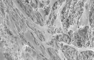 10 Regeneration Bone Grafting & Soft Tissue Management OSTEON