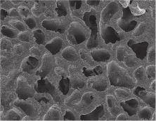 Composition of OSTEON TM II Osteoconductive biphasic calcium phosphate with higher β-tcp OSTEON