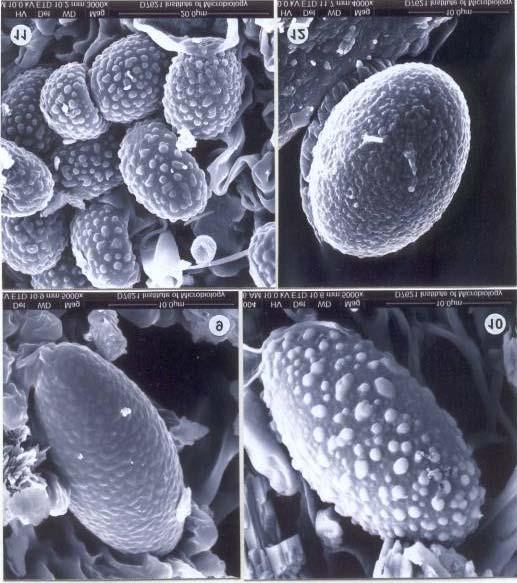 Figs. 9-12. SEM ascospore surface morphology. 9. Melastiza daliensis (HMAS 27696); 10. Scutellinia ahmadiopsis (HMAS 30779); 11. Scutellinia beijingensis (HMAS 31073); 12.