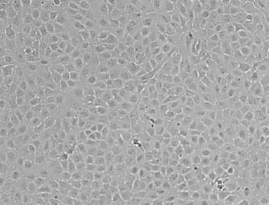 In vitro alveolar models TT1 cells - Transformed