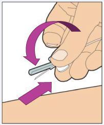 Place the wing and the safety shield between your thumb and index finger.