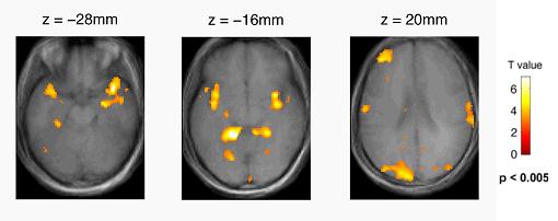 Brain recruitment during rest The medial temporal lobe Christoff et al.