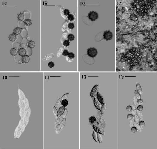 Fungal Diversity Figs. 10-17. Ascoyunnania aquatica (from holotype). Sequence of germination of ascospores in asci to produce secondary spores. 10. Ungerminated ascospores in asci when first placed on PDA.