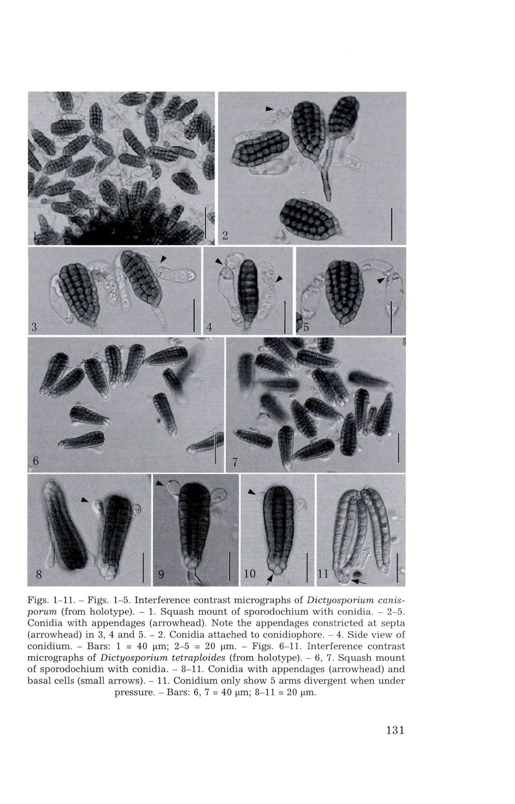 8 Figs. 1-11. - Figs. 1-5. Interference contrast micrographs of Dictyosporium canisporum (from holotype). - 1. Squash mount of sporodochium with conidia. - 2-5. Conidia with appendages (arrowhead).