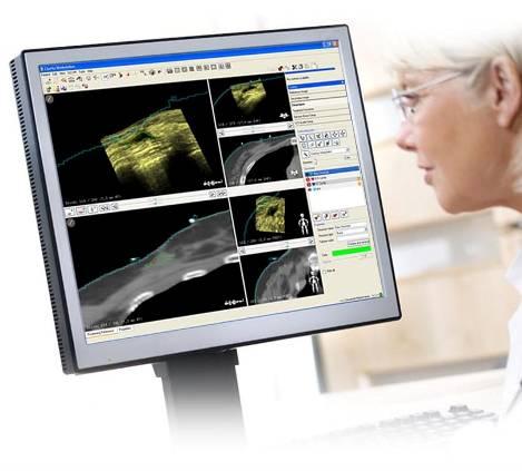 Clarity Superior soft tissue visualization 4D imaging platform for radiation therapy that provides Accurate, structure-based
