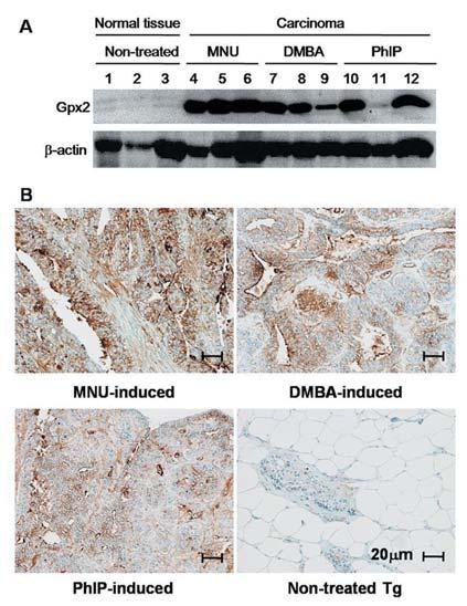 109 Figure. A. Western blot of normal mammary tissue and carcinoma in Hras rats. Lane to, normal mammary tissue. Lane to, carcinogen-induced mammary cancer; to, MNU, to, DMBA,and to, PhIP-induced. C.