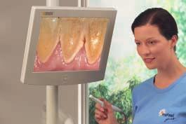 intensity High-intensity operating light Optional patient communication system (flat panel monitor plus intraoral camera) for effective counselling Outstanding ergonomics.