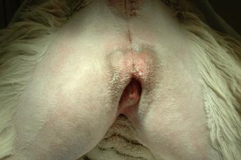 Molly Vaginal palpation : Stricture at the level of