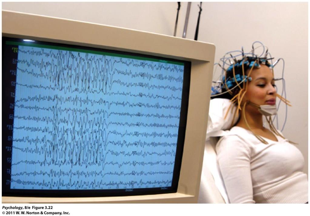 Modern EEG recording Brain activity measured by