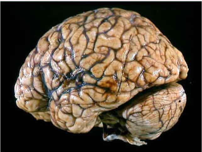 The Brain Grouping of nerve tissue within the skull Weighs around 1.