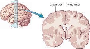Some neuroanatomy Grey matter (GM): The collection of the brain s cell bodies http://users.tamuk.